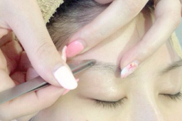 ⑤ツイーザー処理