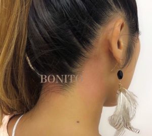 美肌改善ワックス　お顔以外にも首やうなじ、背中の部分ワックスも人気です。