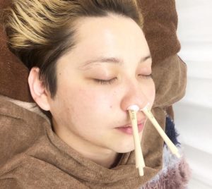 メンズにも大人気の美肌改善ワックスとノーズワックス！毛がごっそり取れます！
