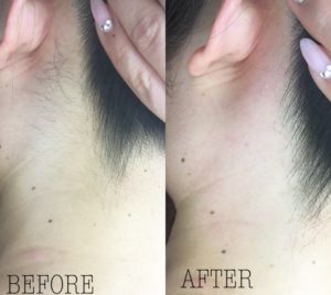 BONITO東京店　6月後半美肌改善ワックス空き状況！