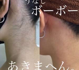 うなじ美人の秘訣は…とっても簡単です！