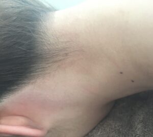 夏に向けて背中のワックスして綺麗にしませんか？