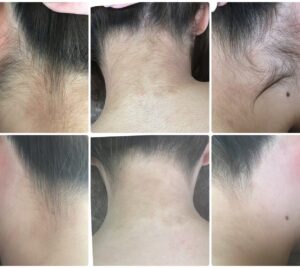 アップスタイルが綺麗に見せれるうなじワックス